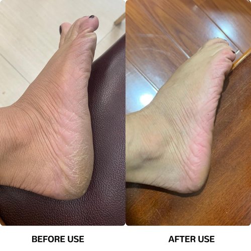 MSDL High Power Electric Foot Callus Remover, 2025 Upgrade with 100-inch Extra-Long Cord and 60 Replaceable Sandpaper Discs, Electric Foot File for Cracked Heels and Dead Skin, Silver