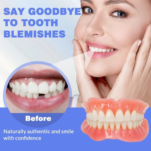 Veneers Teeth for Women, DIY Denture Kit, Do It Yourself False Teeth, Upper and Lower Matching Set, Fix Your Smile at Within Minutes, 1PCS - U7