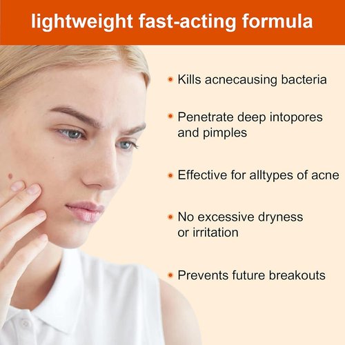 Regine Switzerland Acne Treatment Cream - Rapid Clearing for Hormonal & Cystic Acne | 30g