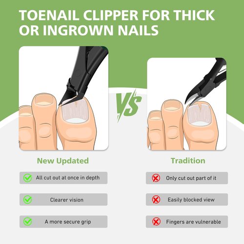 BALUCA Straight Edge Toenail Clippers for Thick Nails & Ingrown Toenails – Heavy Duty Straight Blade Toe Nail Clipper with Long Handle, Toe Nail Cutters for Adults, Seniors, Men and Women -Black
