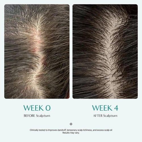 Lilyeve SCALPTURN Cica PDRN Scalp Serum - Strengthen Hair Roots & Relieve Itchy Scalp | 3.38 fl. oz