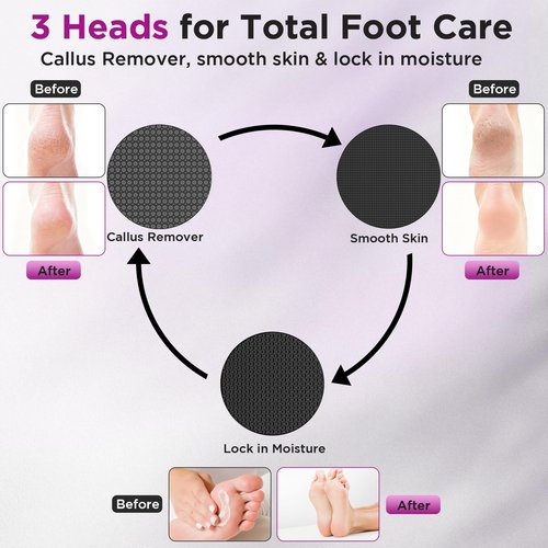 Electric Foot Callus Remover, Apply Oil,Foot SPA, Foot File,Reusable Nano-Glass Head, Ergonomic Premium Aluminum Callus Remover for feet, Rechargeable Pedicure Tools for Feet,Gifts for Men Women