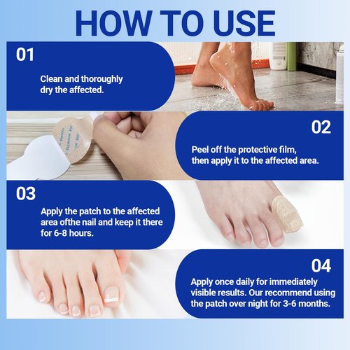 Toenail Fungus Treatment Extra Strength - 21 Pcs Fungal Nail Patches, Foot Nails Repair & Strengthen Patches for Women & Men (1 Count (Pack of 21))