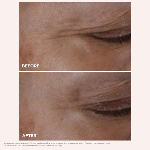Clarins Total Eye Lift - Anti-Aging Eye Cream for Wrinkles, Dark Circles & Puffiness | Refillable