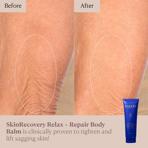 Nakery SkinRecovery Relaxing Magnesium Balm - Skin Tightening Cream for Body with SepiLift & Retinol - Muscle Balm with Melatonin for Restful Sleep - Hydrating Dry Skin Cream with Shea Butter