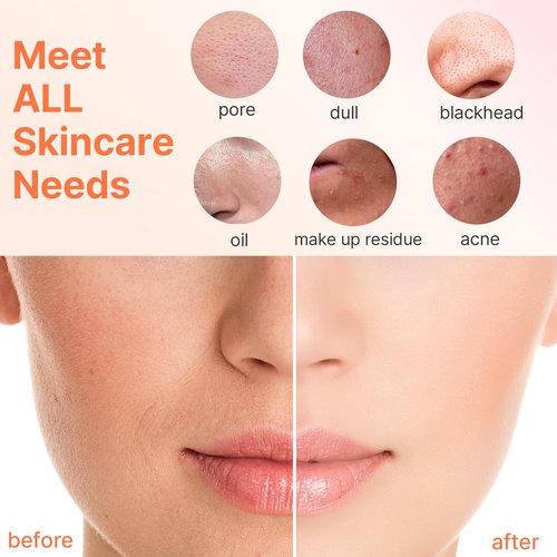 Face Scrubber with 3 Brush Heads & 2 Speeds - Deep Cleaning, Exfoliating, and Massaging for All Skin Types - Facial Cleansing Brush Includes Silicone Head, Travel Case & Free-Plastic Packaging
