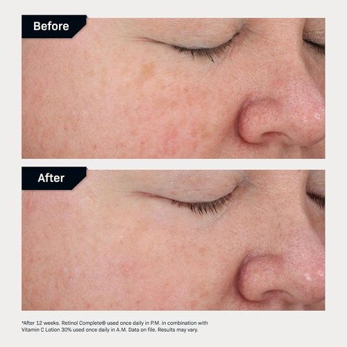 Revision Skincare Retinol Complete® 0.5 Anti-Aging Serum - Hydrating Formula Reduces Fine Lines & Wrinkles