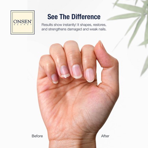 Onsen Secret Japanese Nail File - Professional 10-Pack Nail Files, Double Sided Natural & Acrylic Filers - 120/180 Grit - Disposable, Salon Smooth | Best Onsen File for Shiny Nails