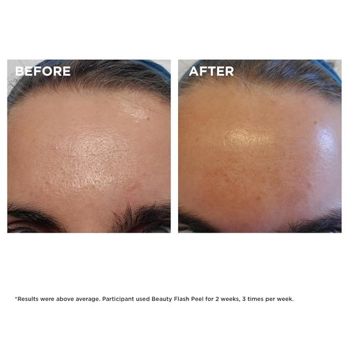 Clarins Beauty Flash Peel - 10-Minute At-Home Facial | Tightens Pores & Refines Texture | All Skin Types