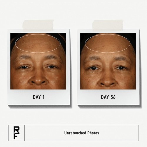 Rodan + Fields Redefine Daily Face Clay Cleanser - Exfoliating Anti-Aging Wash for Sensitive Skin (125 mL)