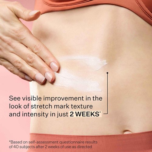 StriVectin SD Advanced™ Plus Intensive Moisturizer for Wrinkles and Stretchmarks, For Face and Body, Collagen Boosting with Peptides and Hyaluronic Acid, 2 Fl Oz (Pack of 1)