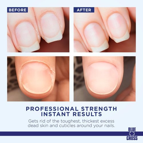 Blue Cross Cuticle Remover & Softener - Hydrating Nail Treatment for Dry Cuticles, 6oz
