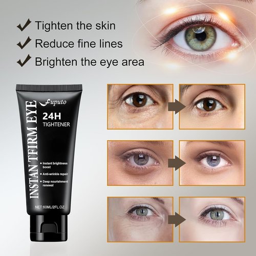 Retinol Eye Cream – 60ML Brightening, Anti-Aging & Firming Under Eye Cream for Dark Circles, Eye Bags, Puffiness & Fine Lines, Deep Hydration for All Skin Types (1 Pack)