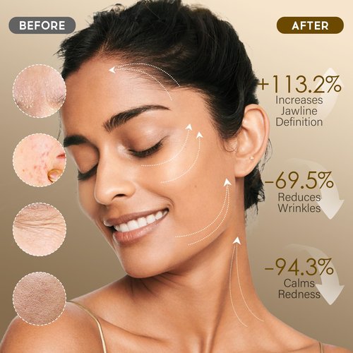 MOSRROU Microcurrent Conductive Gel Hydrating Collagen Leave-On Primer for Face Conductivity Gel with Hyaluronic Acid Snail Mucin Centella Asiatica Fragrance-Free Paraben-Free Work with Facial Device