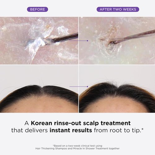Dr. Groot Miracle Hair Treatment - Moisturizing Rinse for Hair Loss with Rosemary Oil | Smooth, Healthy Hair in 5 Seconds