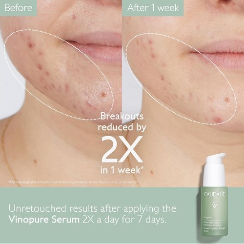 Caudalie Vinopure Pore Minimizing Serum - Natural Salicylic Acid & Niacinamide, 30 mL