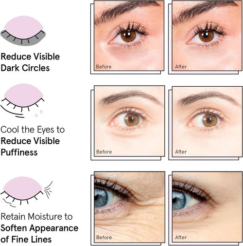 grace & stella Award Winning Under Eye Mask - Birthday Gifts for Women - Gel Eye Patches for Dark Circles, Puffy Eyes, Undereye Bags - Gifts for Mom - Travel Essentials - Vegan (24 Pairs, Gold)