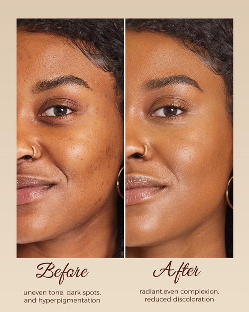 SecuMake Kojic Acid Soap, Brightening & Hydrating Turmeric Soap Bar for Dark Spots with Vitamin C and Shea Butter, Paraben & Sulfate-Free - 1 Bars