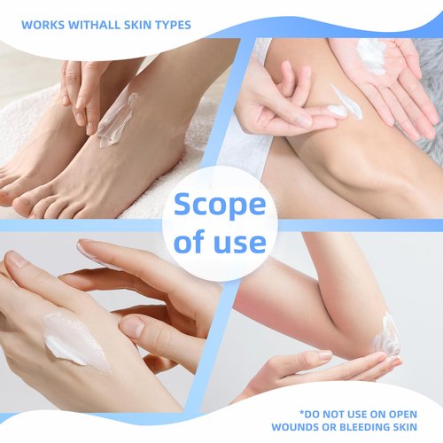 QQWIAX 40% Urea Cream – Foot, Hand & Heel Cream for Dry, Cracked Skin, Callus & Rough Elbows – Intensive Moisturizing Lotion for Feet, Hands & Knees-0.6oz