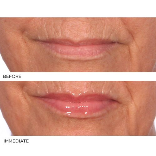 NassifMD Hydro-Screen Lip Plumping Oil - Hydrating Hyaluronic Acid Serum for Soft, Smooth Lips