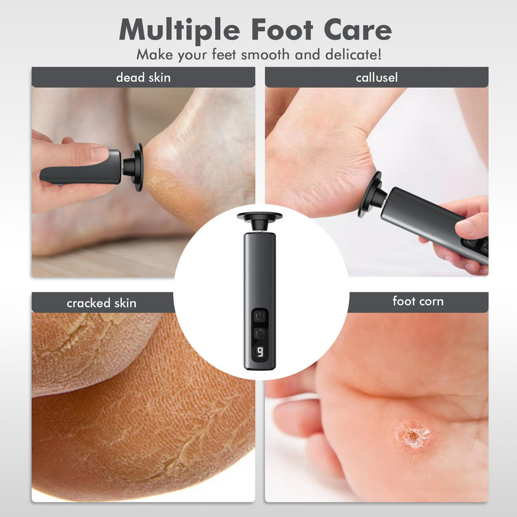 Waysse Electric Foot Callus Remover, Callus Remover for Feet with 9 Adjustable Speeds,Rechargeable Pedicure Tool with Replacement Sandpaper Discs for Dead Skin Calluses