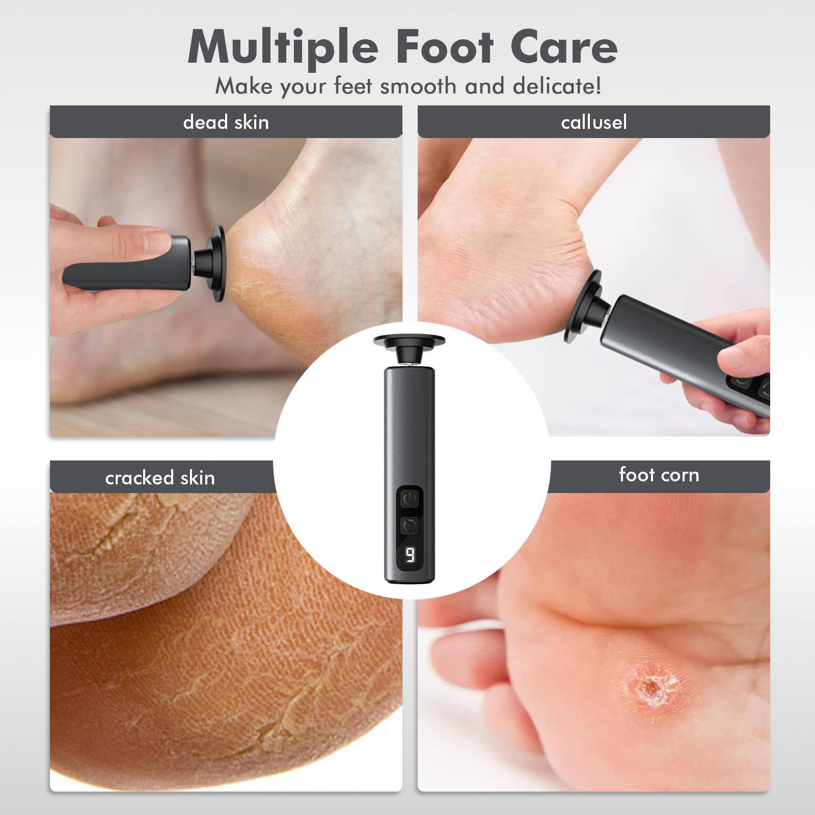 Waysse Electric Foot Callus Remover, Callus Remover for Feet with 9 Adjustable Speeds,Rechargeable Pedicure Tool with Replacement Sandpaper Discs for Dead Skin Calluses
