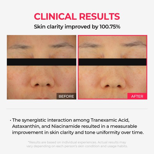 Dr.Melaxin TXA Astaxanthin Overnight Wrapping Peel-Off Mask – Skin Tone Improving, Hydrating & Firming Overnight Face Mask for Glow & Texture Refinement