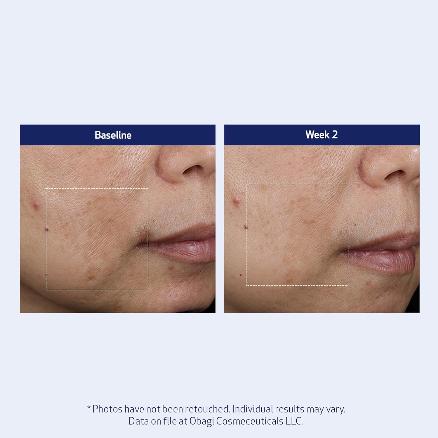 SUZANOBAGIMD Super Antioxidant Serum - Reduces Fine Lines & Wrinkles, Brightens Skin Tone - 1 oz