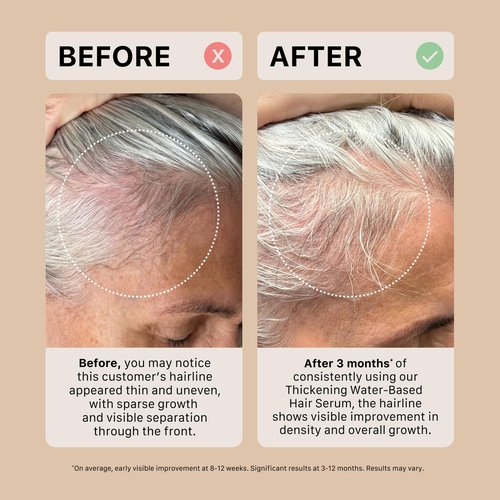 ACTIIV Ultimate Power Trio for Women - Boost Fuller-Looking Hair & Strengthen Scalp | Vegan, Color-Safe Shampoo, Conditioner & Serum