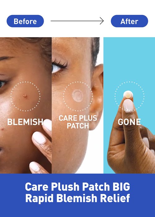 OLIVE YOUNG Care Plus Spot Patch Big (81 Count) | Hydrocolloid Patch, Spot Stickers for Acne Pimple and Zits