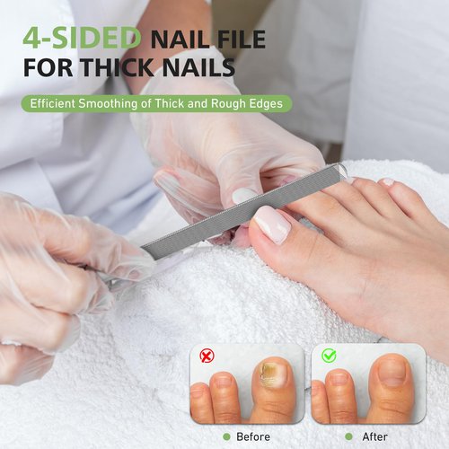 BALUCA Toenail File for Thick Nails & Ingrown Relief | Heavy Duty Metal Emery Board with Toenail Lifter for Seniors, Coarse Grit & Durable Stainless Steel Design (Silver, 1.0, Count, 180/240 Grit)