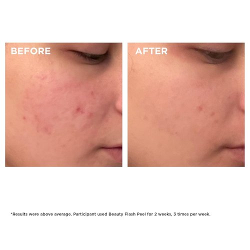Clarins Beauty Flash Peel - 10-Minute At-Home Facial | Tightens Pores & Refines Texture | All Skin Types