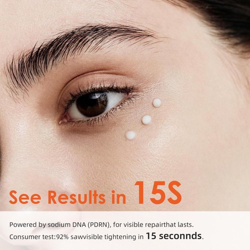 15-Second Instant Eye Lift Cream with Sodium DNA & 0.1% Retinal | Rapid Tightening for Eye Bags & Fine Lines | Dual-Action Firming + Long-Term Repair | Caffeine, Peptides & Collagen Complex | 0.7fl oz