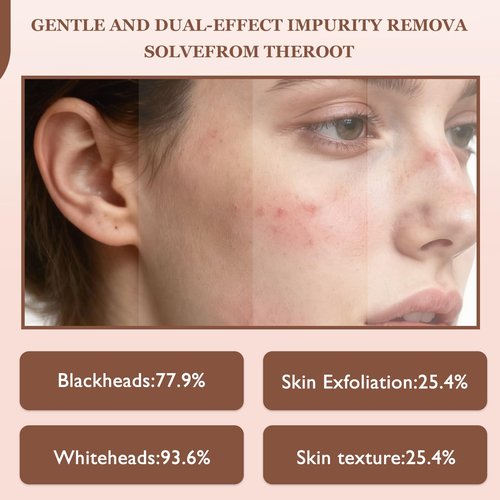 Rice Peel Shot Glow Rice Ampoule Duo | Pore Minimizing Gentle Peel & Deep Hydration |Black Rice Exfoliant for All Skin | 6.76 Fl Oz 2Pcs