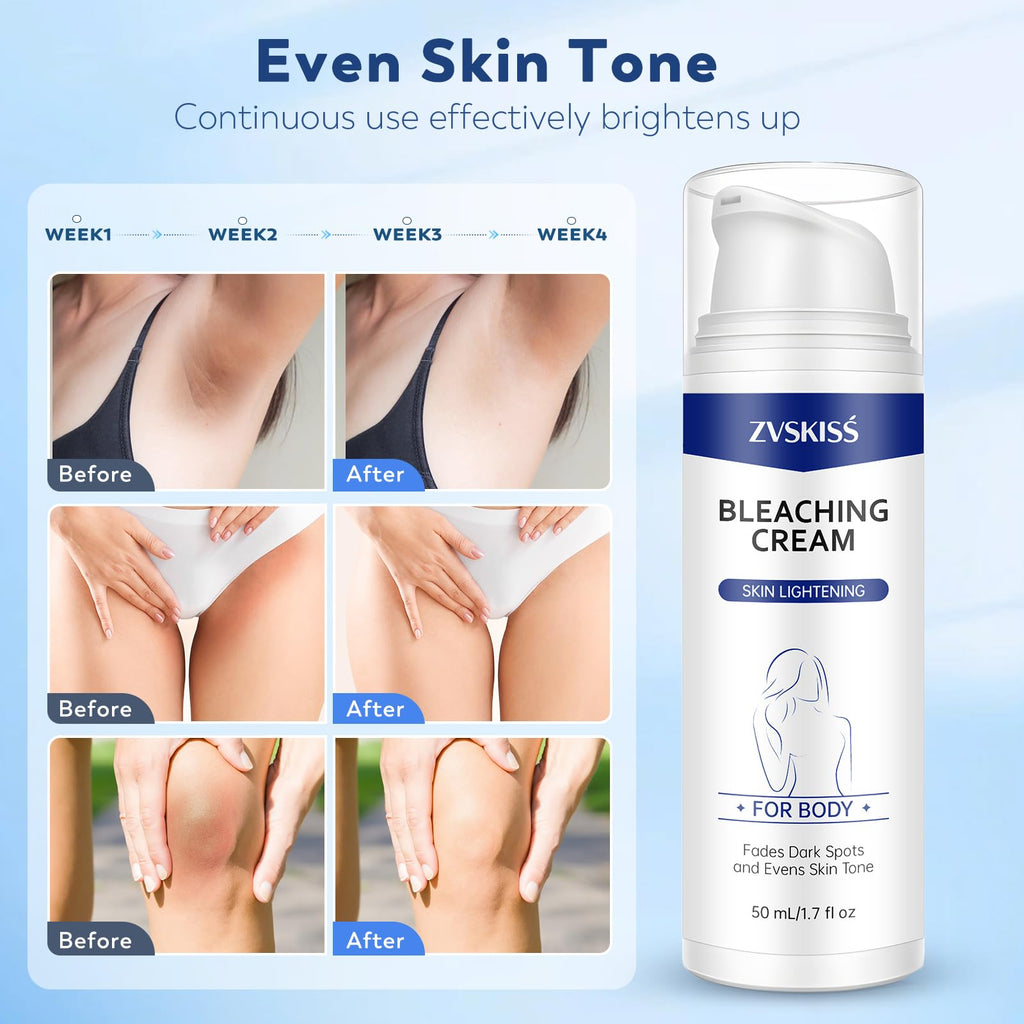 ZVSKISS Skin Bleaching Cream - for Intimate Areas & Body, Vitamin C Dark Spot Remover for Underarms, Knees, Elbows, Inner Thighs, Bikini Line, Sensitive Skin care Cream- 1.7fl oz