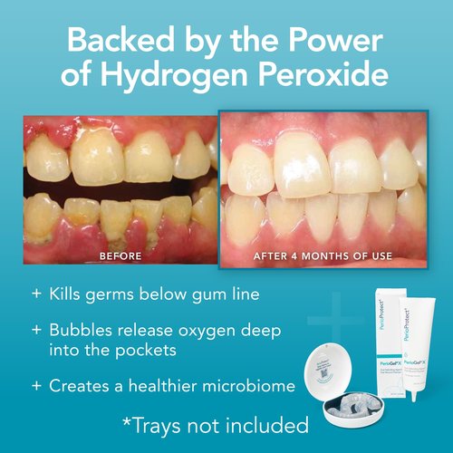 PerioGelX | Periodontal Treatment for Teeth | Promotes Teeth Whitening (3 oz.)