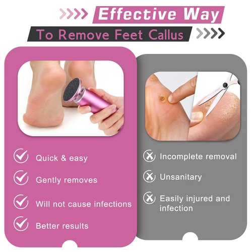 Electric Foot Callus Remover,Callus Remover for Feet,with 60pcs Sanding Disc,Electric Speed Adjustable Foot File for Dead Skin Cracked Skin Calluses for Men and Women