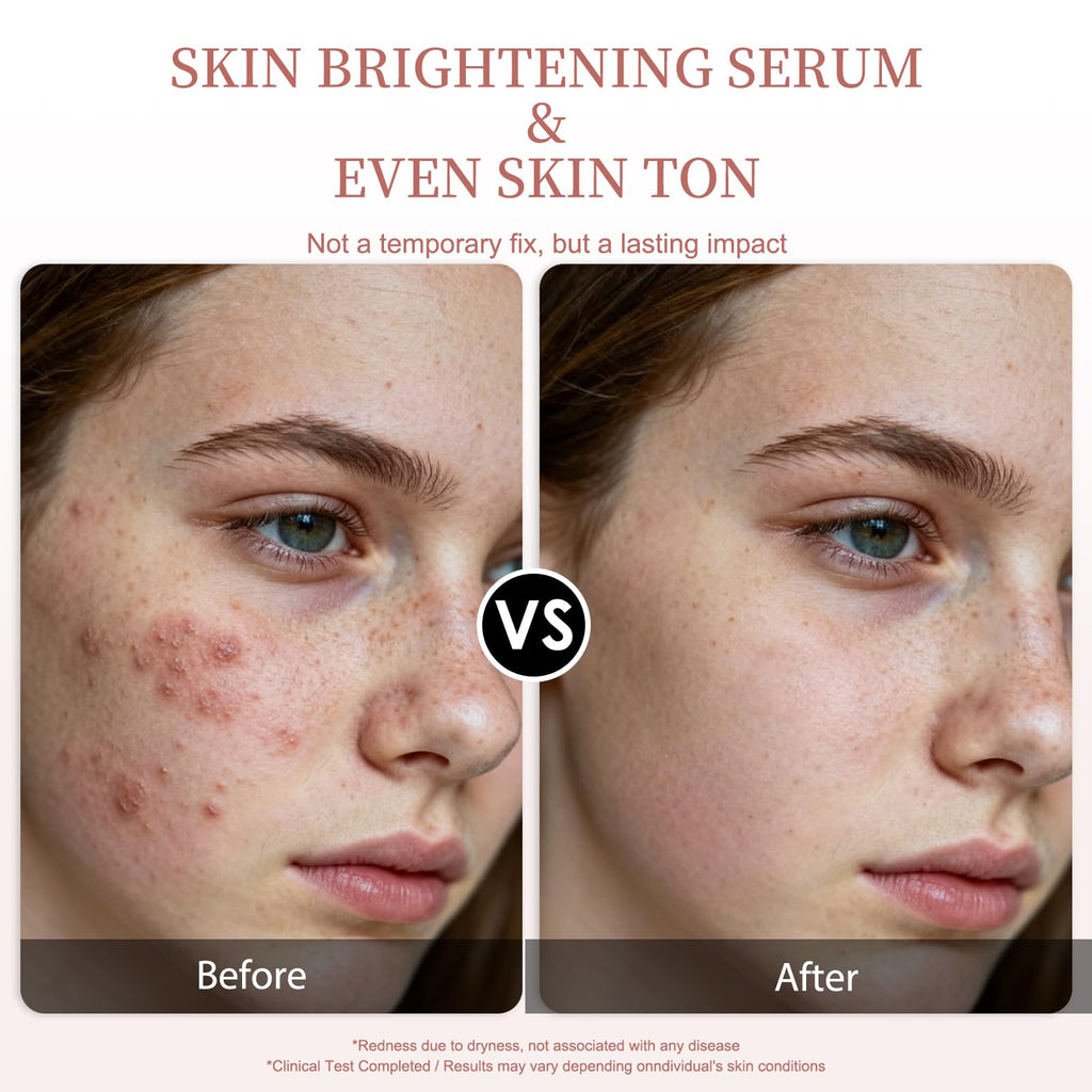 Vitamin C Serum for Face – Brightening & Anti-Aging & Wrinkle Facial Serum With Vitamin C, Sodium Hyaluronate, Vitamin E And More. Hydrating Dark Spot Corrector to Even Skin Tone & Glow, 1 fl oz