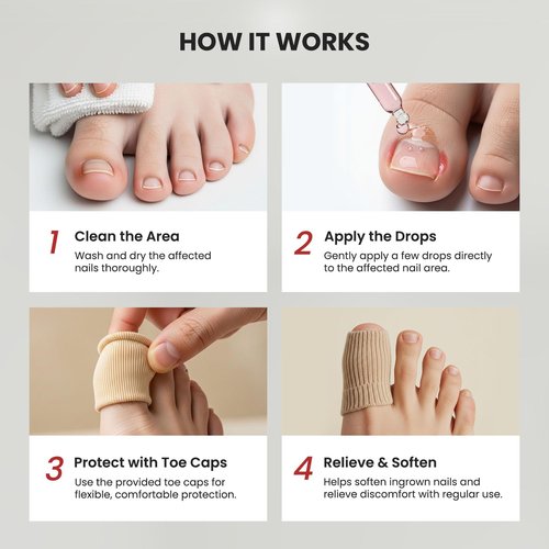 Treatonic Ingrown Toenail Treatment - Ingrown Toenail Pain Reliever and Softener Kit for Easy Trimming with Silicone Gel Toe Caps
