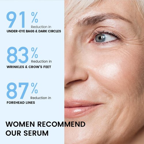 RONKIE Instant Eye Face Lift Cream: Reduces Eye Bags Wrinkles Puffy Eyes Dark Circles Crow’s Feet in Minutes for Mature Skin of Middle-aged Women 1 Fl Oz