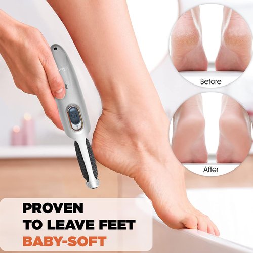 Powerful Electric Foot Callus Remover for Men - Rechargeable Pedicure Foot Grinder Files Away Dead, Hard Skin and Calluses on Heels for Smooth Soft Feet (Silver Grey)