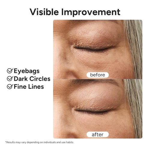 In My Eyes Eye Repair Gel Cream - Caffeine & Lutein Anti-Wrinkle Treatment for Dark Circles | 0.5 oz.