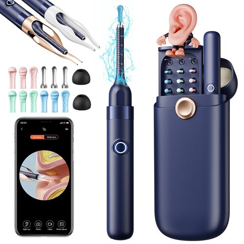 Ear Wax Removal, Ear Cleaner with Camera 1296P HD,Visual Ear Cleaner with 6 LED Lights and Flexible Tip,FSA HSA Eligible Items,Safe Ear Wax Removal Kit with Camera,Ear Cleaning Tool for Family Gifts