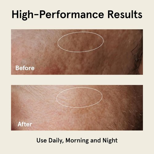 JAXON LANE Relax And Repair Anti-Aging Face Moisturizer For Men - Hydrating Night Cream With Niacinamide & Hyaluronic Acid