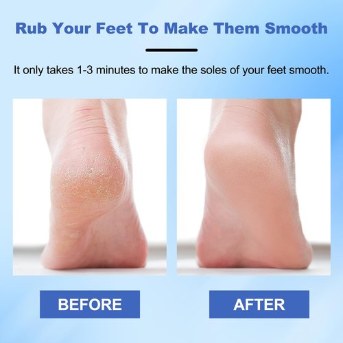 Veinsgrain Foot File, Nano Glass Foot File, Hard Skin Remover Nano-Glass Foot File, Veins Grain Foot File, Professional Foot Care Tools, Pedicure Tool for Smooth Feet (Blue)