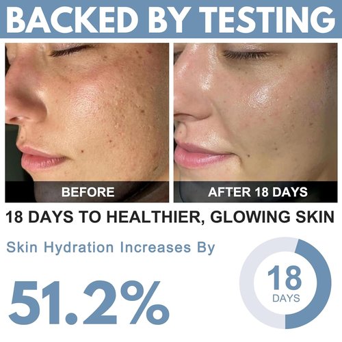 Ribose Cream - Anti-Aging Moisturizer with D-Ribose & Coconut Oil | Reduces Wrinkles, 2.5 oz