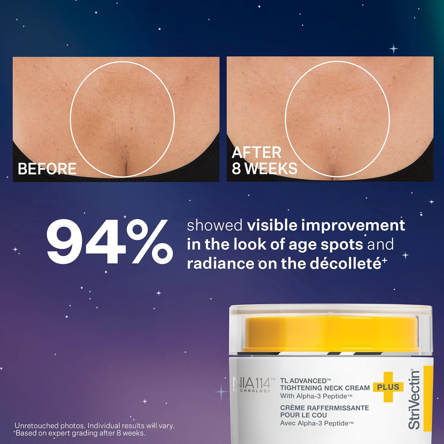 StriVectin TL Advanced Tighten and Sculpt Kit - Brighten & Lift Skin Tone with Peptides & Hyaluronic Acid
