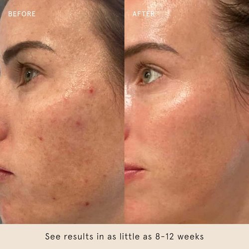 Barefaced Retinal Skin Therapy Serum - Firming Retinaldehyde & Bakuchiol Formula for Youthful Skin | 30ml