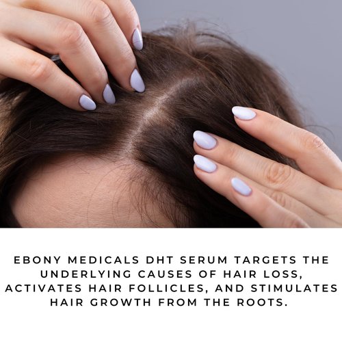Ebony Medical Hair Support Serum – DHT-Blocking Procapil Formula – Strengthens Thinning Hair & Scalp Health – Liposomal Scalp Serum for Fuller, Thicker Hair – 2 fl oz