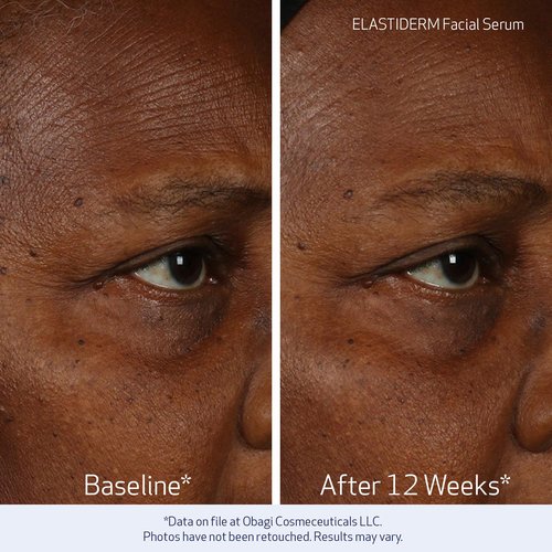 Obagi ELASTIDERM Facial Serum & Eye Serum Set - Firm Skin, Reduce Signs of Aging & De-Puff Eyes | 1oz & 0.47oz